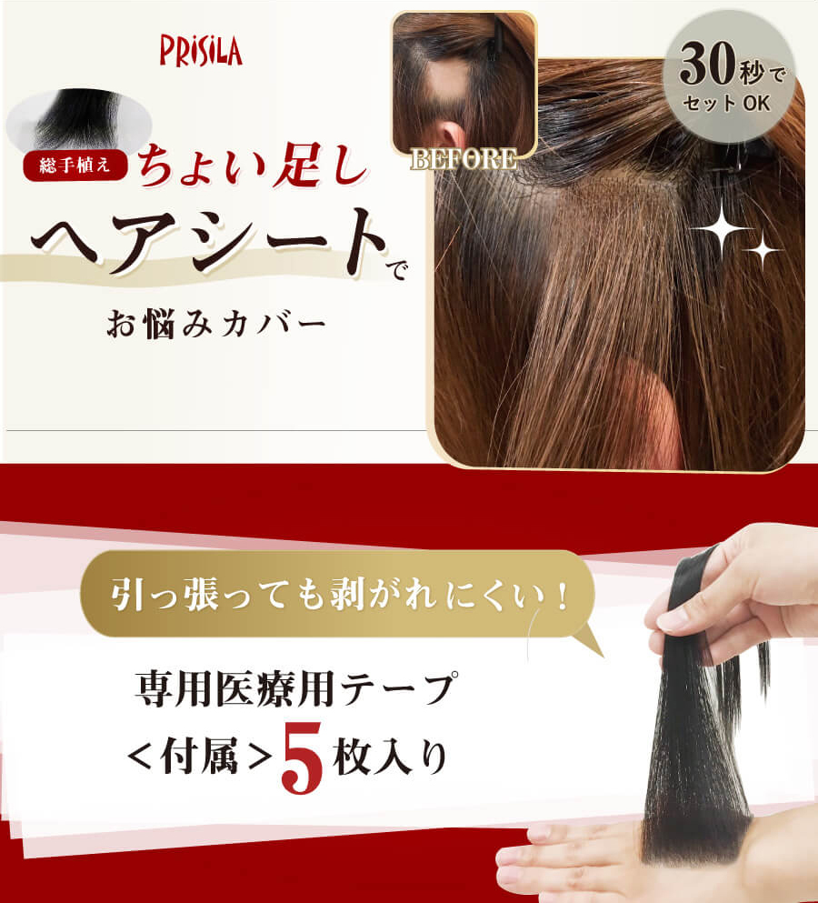 円形脱毛症や抜け毛などでお悩みの方に ちょい足しヘアシート ウィッグとエクステのプリシラ 公式通販サイト